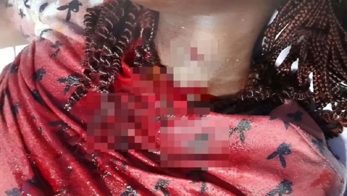 Sikensi : Un maçon tente d'égorger sa copine avant de prendre l...